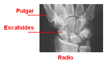 Articulación de la mano