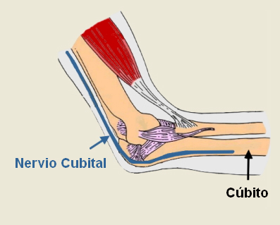 Análisis del nervio cúbito